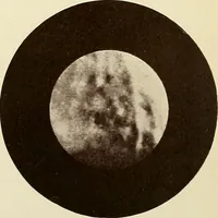 An illustration from A practical treatise on genito-urinary and venereal diseases and syphilis / By Robert W. Taylor. (1904)