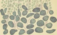 An illustration from A practical treatise on genito-urinary and venereal diseases and syphilis / By Robert W. Taylor. (1904)