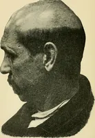 An illustration from A practical treatise on genito-urinary and venereal diseases and syphilis / By Robert W. Taylor. (1904)