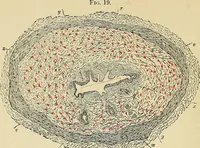 An illustration from A practical treatise on genito-urinary and venereal diseases and syphilis / By Robert W. Taylor. (1904)