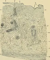 An illustration from A practical treatise on genito-urinary and venereal diseases and syphilis / By Robert W. Taylor. (1904)