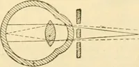 An illustration from A manual of physiology : with practical exercises / by G. N. Stewart ; with coloured plate and 467 other illustrations. (1914)