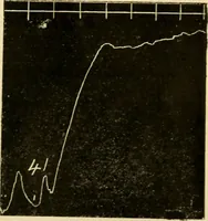 An illustration from A manual of physiology : with practical exercises / by G. N. Stewart ; with coloured plate and 467 other illustrations. (1914)