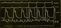 Picture 24 of 351 from A manual of physiology : with practical exercises / by G. N. Stewart ; with coloured plate and 467 other illustrations. (1914), leaf 124