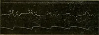 An illustration from A manual of physiology : with practical exercises / by G. N. Stewart ; with coloured plate and 467 other illustrations. (1914)