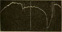 An illustration from A manual of physiology : with practical exercises / by G. N. Stewart ; with coloured plate and 467 other illustrations. (1914)