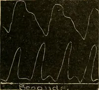 An illustration from A manual of physiology : with practical exercises / by G. N. Stewart ; with coloured plate and 467 other illustrations. (1914)