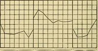 Picture 122 of 351 from A manual of physiology : with practical exercises / by G. N. Stewart ; with coloured plate and 467 other illustrations. (1914), leaf 424