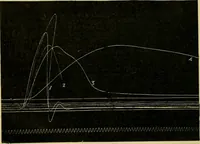 An illustration from A manual of physiology : with practical exercises / by G. N. Stewart ; with coloured plate and 467 other illustrations. (1914)
