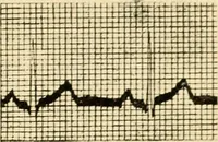 An illustration from A manual of physiology : with practical exercises / by G. N. Stewart ; with coloured plate and 467 other illustrations. (1914)