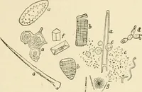An illustration from Human physiology : prepared with special reference to students of medicine / by Joseph Howard Raymond. (1901)