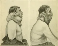 An illustration from Human physiology : prepared with special reference to students of medicine / by Joseph Howard Raymond. (1901)