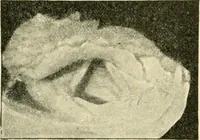 An illustration from Human physiology : prepared with special reference to students of medicine / by Joseph Howard Raymond. (1901)