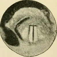 An illustration from Human physiology : prepared with special reference to students of medicine / by Joseph Howard Raymond. (1901)