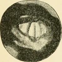 An illustration from Human physiology : prepared with special reference to students of medicine / by Joseph Howard Raymond. (1901)