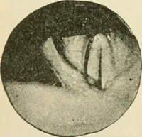 An illustration from Human physiology : prepared with special reference to students of medicine / by Joseph Howard Raymond. (1901)