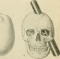 An illustration from Human physiology : prepared with special reference to students of medicine / by Joseph Howard Raymond. (1901)