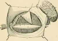 An illustration from Human physiology : prepared with special reference to students of medicine / by Joseph Howard Raymond. (1901)