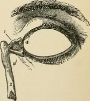 An illustration from Human physiology : prepared with special reference to students of medicine / by Joseph Howard Raymond. (1901)