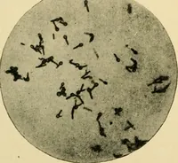 Picture 10 of 224 from The principles and practice of modern surgery / by Roswell Park ... with 722 engravings and 60 full-page plates in colors and monochrome. (1907), leaf 106