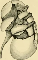 An illustration from The principles and practice of modern surgery / by Roswell Park ... with 722 engravings and 60 full-page plates in colors and monochrome. (1907)