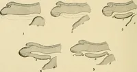 An illustration from The principles and practice of modern surgery / by Roswell Park ... with 722 engravings and 60 full-page plates in colors and monochrome. (1907)