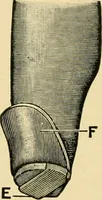 An illustration from The principles and practice of modern surgery / by Roswell Park ... with 722 engravings and 60 full-page plates in colors and monochrome. (1907)