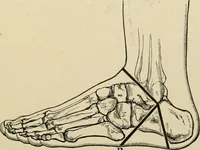 An illustration from The principles and practice of modern surgery / by Roswell Park ... with 722 engravings and 60 full-page plates in colors and monochrome. (1907)