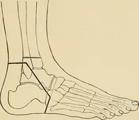An illustration from The principles and practice of modern surgery / by Roswell Park ... with 722 engravings and 60 full-page plates in colors and monochrome. (1907)