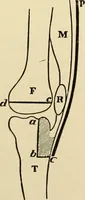 An illustration from The principles and practice of modern surgery / by Roswell Park ... with 722 engravings and 60 full-page plates in colors and monochrome. (1907)