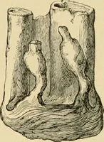An illustration from The principles and practice of modern surgery / by Roswell Park ... with 722 engravings and 60 full-page plates in colors and monochrome. (1907)
