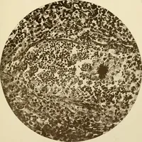An illustration from The principles and practice of modern surgery / by Roswell Park ... with 722 engravings and 60 full-page plates in colors and monochrome. (1907)