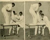 An illustration from The principles and practice of modern surgery / by Roswell Park ... with 722 engravings and 60 full-page plates in colors and monochrome. (1907)