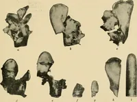 Picture 21 of 224 from The principles and practice of modern surgery / by Roswell Park ... with 722 engravings and 60 full-page plates in colors and monochrome. (1907), leaf 247