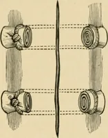Picture 26 of 224 from The principles and practice of modern surgery / by Roswell Park ... with 722 engravings and 60 full-page plates in colors and monochrome. (1907), leaf 269