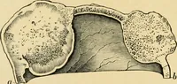An illustration from The principles and practice of modern surgery / by Roswell Park ... with 722 engravings and 60 full-page plates in colors and monochrome. (1907)