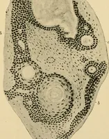 Picture 34 of 224 from The principles and practice of modern surgery / by Roswell Park ... with 722 engravings and 60 full-page plates in colors and monochrome. (1907), leaf 317