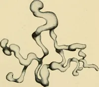 Picture 35 of 224 from The principles and practice of modern surgery / by Roswell Park ... with 722 engravings and 60 full-page plates in colors and monochrome. (1907), leaf 322