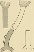 An illustration from The principles and practice of modern surgery / by Roswell Park ... with 722 engravings and 60 full-page plates in colors and monochrome. (1907)