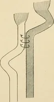 An illustration from The principles and practice of modern surgery / by Roswell Park ... with 722 engravings and 60 full-page plates in colors and monochrome. (1907)