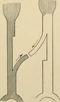An illustration from The principles and practice of modern surgery / by Roswell Park ... with 722 engravings and 60 full-page plates in colors and monochrome. (1907)
