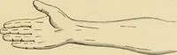 An illustration from The principles and practice of modern surgery / by Roswell Park ... with 722 engravings and 60 full-page plates in colors and monochrome. (1907)