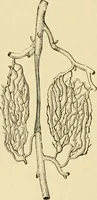 An illustration from The principles and practice of modern surgery / by Roswell Park ... with 722 engravings and 60 full-page plates in colors and monochrome. (1907)