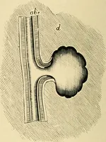 An illustration from The principles and practice of modern surgery / by Roswell Park ... with 722 engravings and 60 full-page plates in colors and monochrome. (1907)