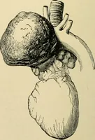 An illustration from The principles and practice of modern surgery / by Roswell Park ... with 722 engravings and 60 full-page plates in colors and monochrome. (1907)
