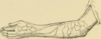 An illustration from The principles and practice of modern surgery / by Roswell Park ... with 722 engravings and 60 full-page plates in colors and monochrome. (1907)