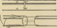 An illustration from The principles and practice of modern surgery / by Roswell Park ... with 722 engravings and 60 full-page plates in colors and monochrome. (1907)