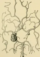 An illustration from The principles and practice of modern surgery / by Roswell Park ... with 722 engravings and 60 full-page plates in colors and monochrome. (1907)
