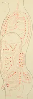 An illustration from The principles and practice of modern surgery / by Roswell Park ... with 722 engravings and 60 full-page plates in colors and monochrome. (1907)