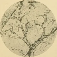 Picture 2 of 224 from The principles and practice of modern surgery / by Roswell Park ... with 722 engravings and 60 full-page plates in colors and monochrome. (1907), leaf 45